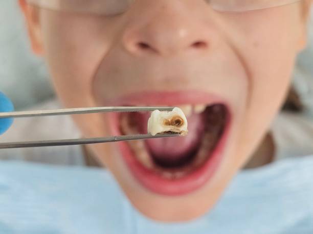 Best Emergency Orthodontic Repairs in Woodfield, SC